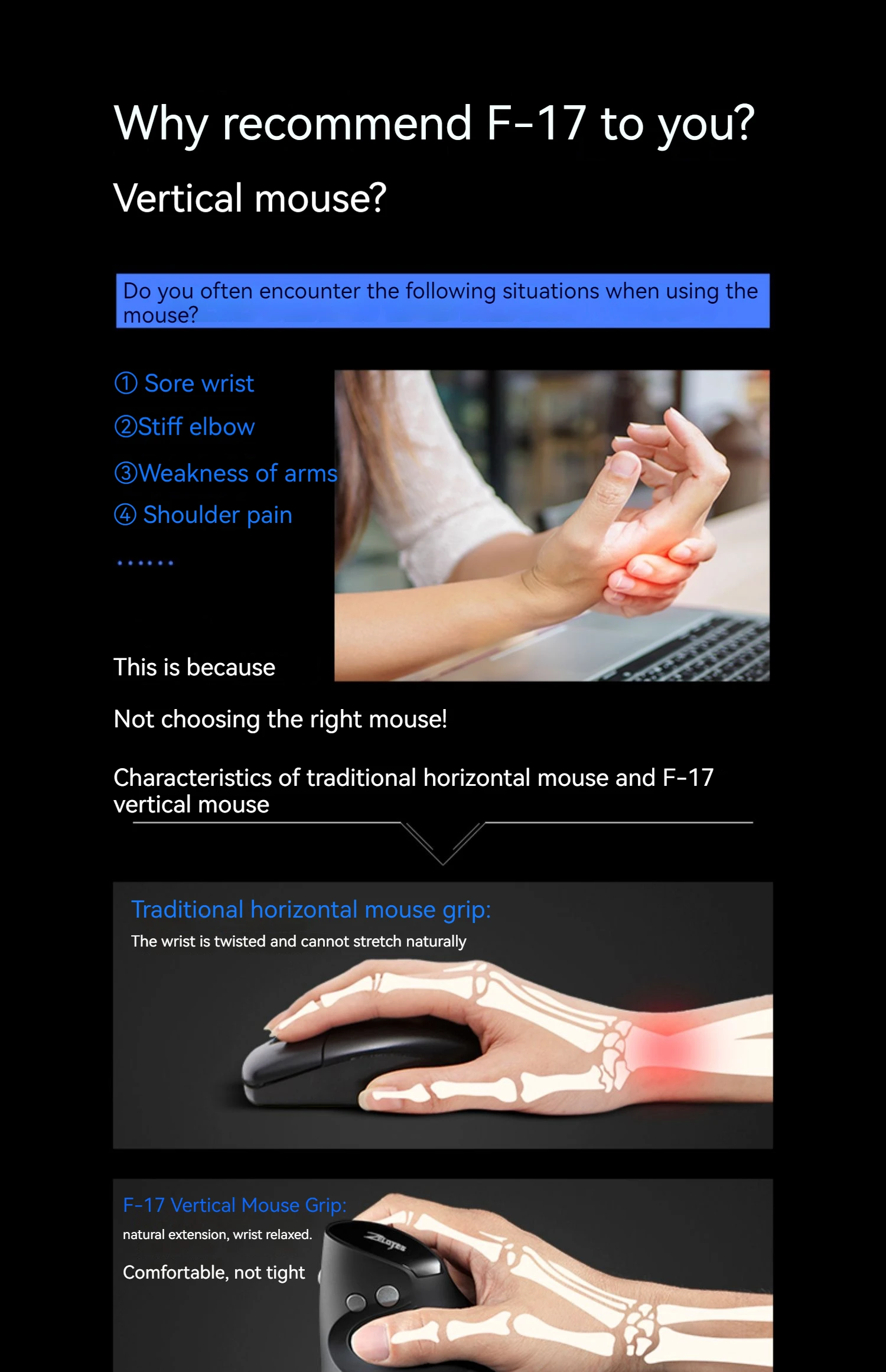 Zelotes F-17 Grip Mouse Vertical 2.4G Wireless Mouse 3-Speed DPI Adjustment Computer Laptop Gaming Mouse